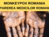 Monkeypox Romania